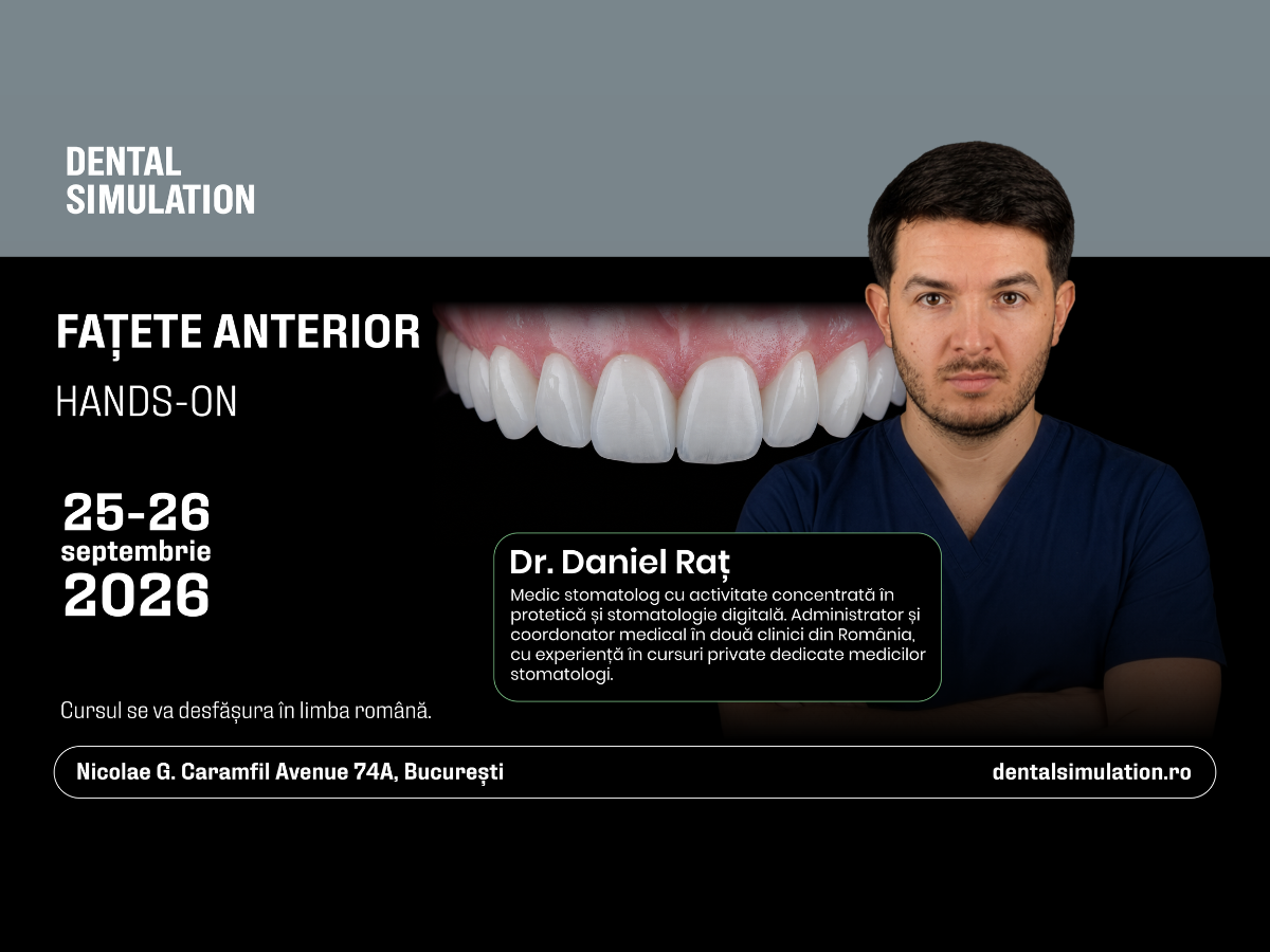 Fațete Anterior
