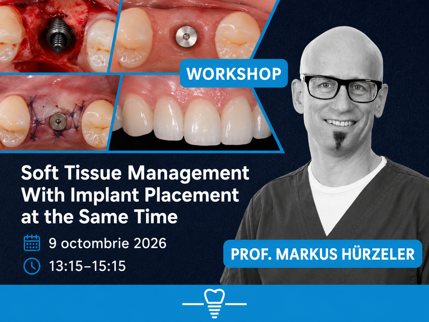 WORKSHOP: Soft Tissue Management With Implant Placement at the Same Time