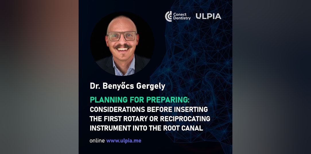 PLANNING FOR PREPARING: CONSIDERATIONS BEFORE INSERTING THE FIRST ROTARY OR RECIPROCATING INSTRUMENT INTO THE ROOT CANAL