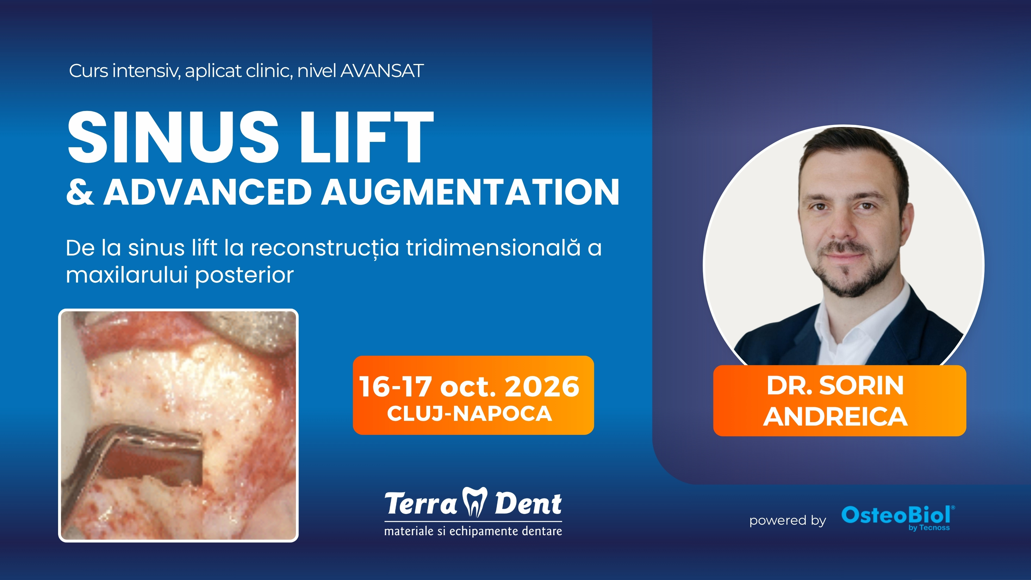 Sinus Lift & Advanced Augmentation
