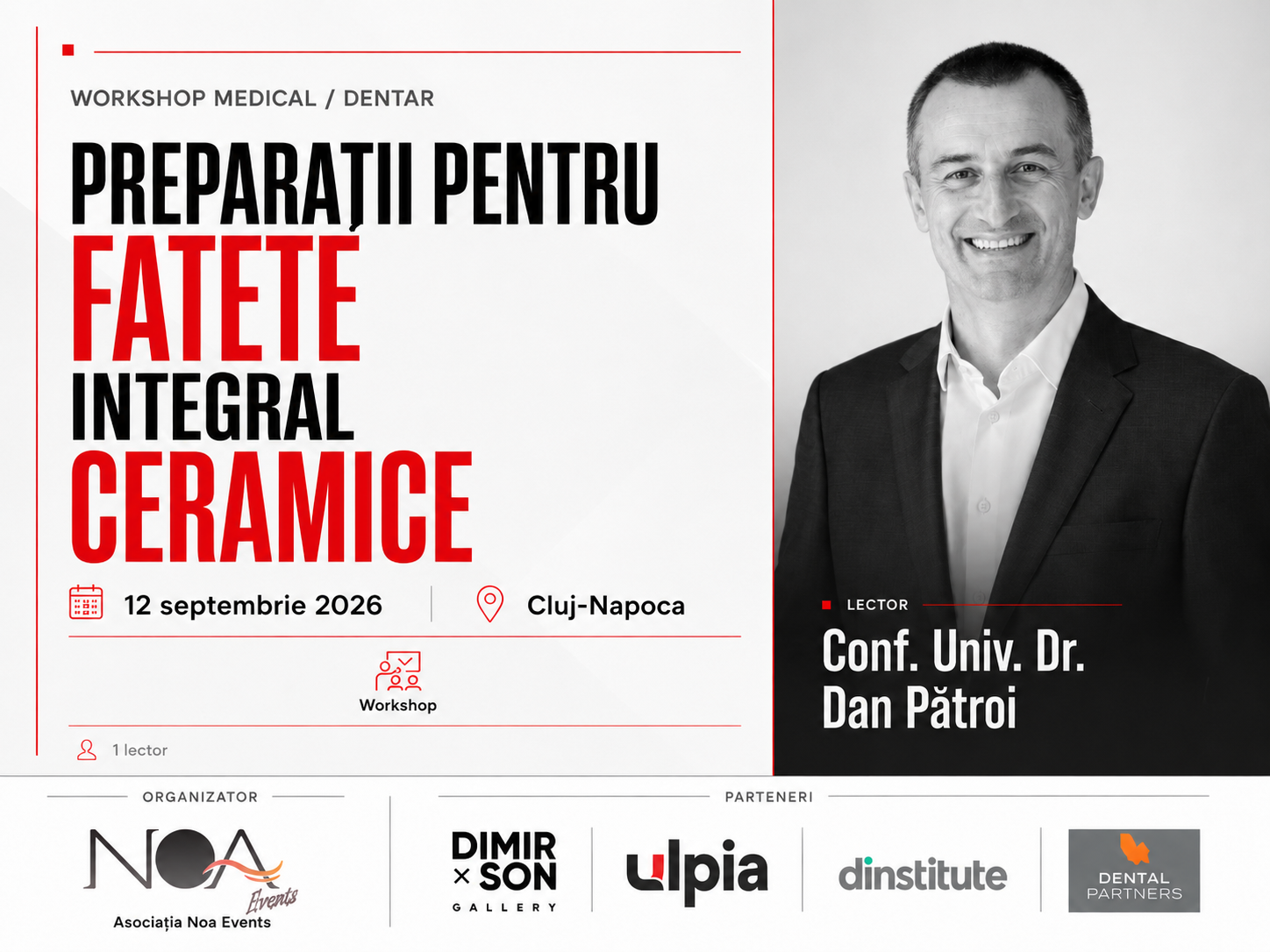 Preparații pentru fațete integral ceramice