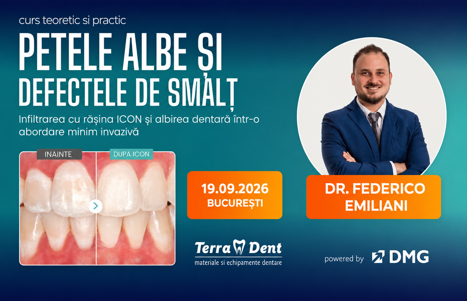 Petele albe si defectele de smalt: de la diagnostic la tratament